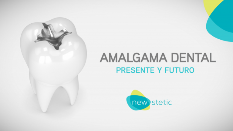 Amalgama Dental