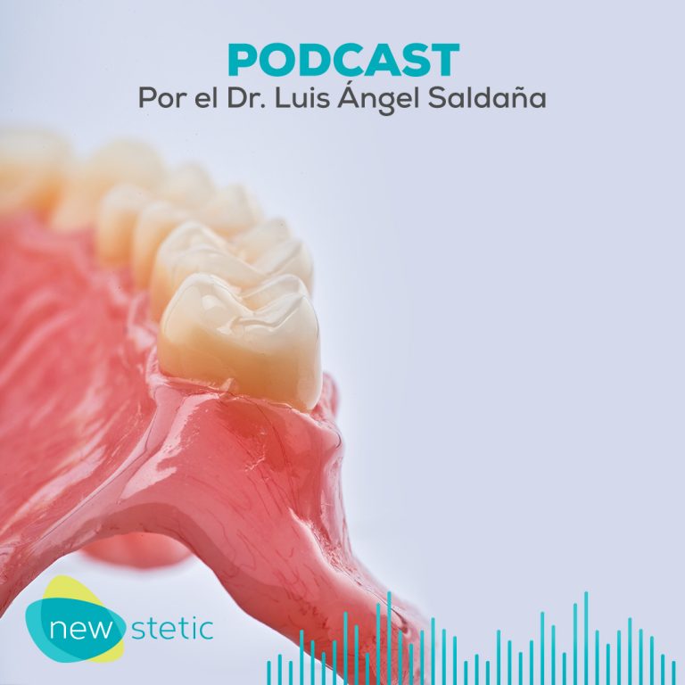 Posterior teeth angulation