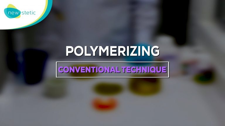 Polymerizing conventional technique (Opti-Cryl High Impact)