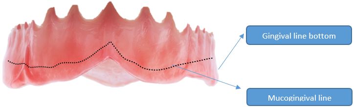 gingival and mucogingival line characterization kit opti-cryl veracril