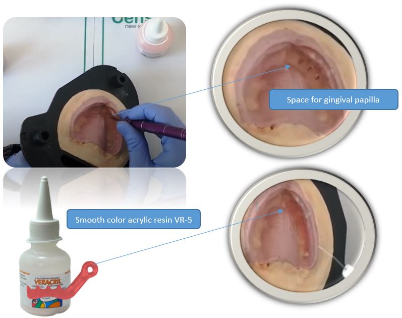 smooth color resin Vr-5 characterization kit opti-cryl veracril