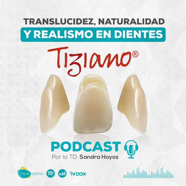 Translucidez, naturalidad y realismo en dientes Tiziano